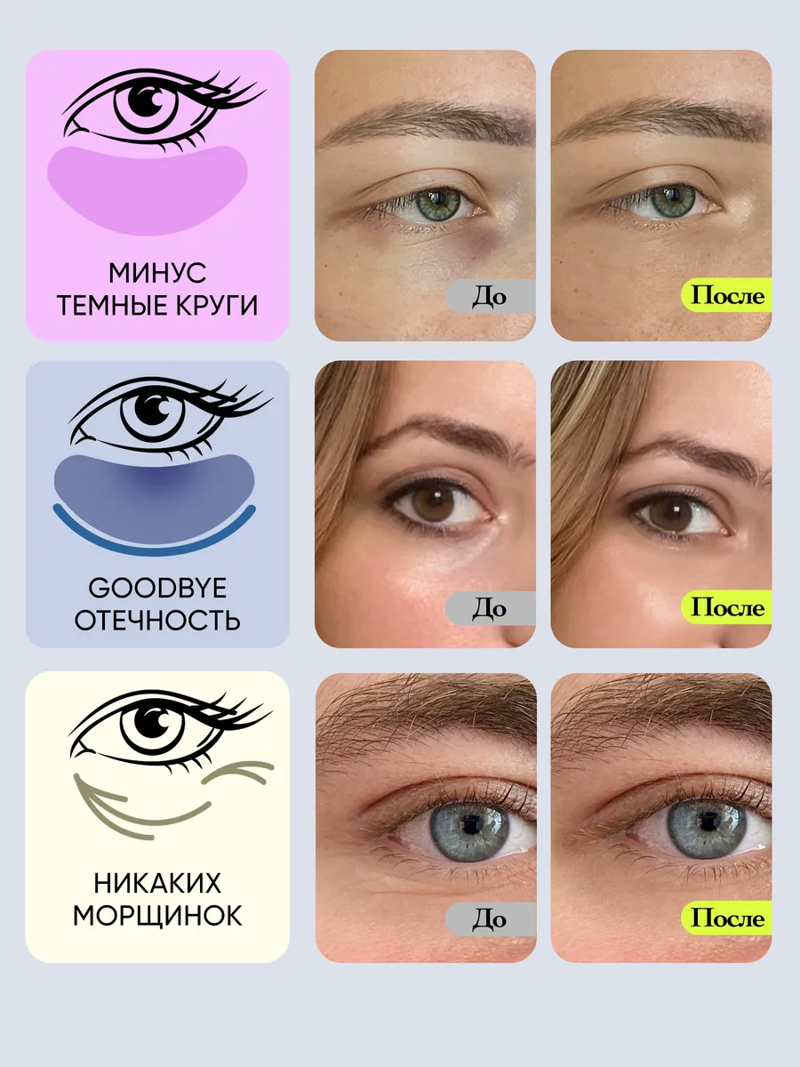 Патчи для глаз от отеков и мешков с голубикой 80 шт VOIS 108789957 купить  за 436 ₽ в интернет-магазине Wildberries