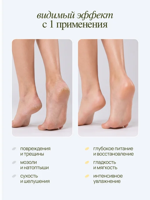 MIXIT Кератолитик для пяток от огрубевшей кожи, вариант, фото 5