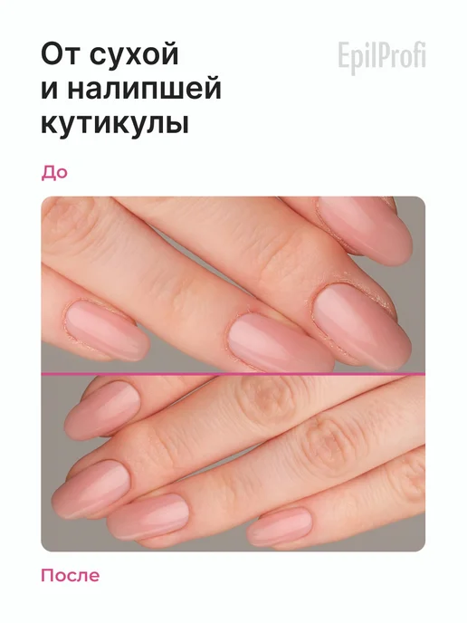EpilProfi Ремувер для удаления кутикулы на руках, вариант, фото 2