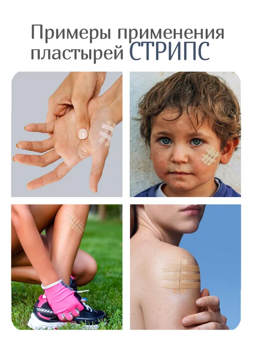 Optimelle Пластыри для стягивания ран Стрипс 13х102 мм 2 уп по 6 штук…, 13x102 мм, фото 3