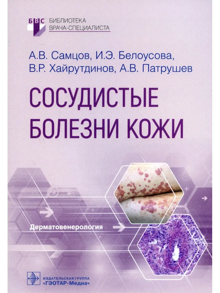 Алексей Самцов и др. Сосудистые болезни кожи ГЭОТАР-Медиа 111530500 купить  за 1 923 ₽ в интернет-магазине Wildberries